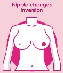 nipple-inversion